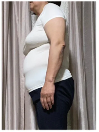 実例①ビフォー