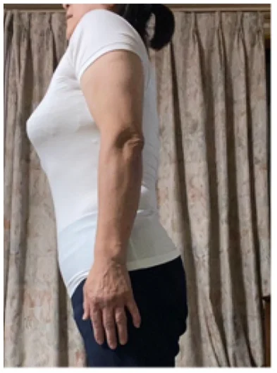 実例①アフター