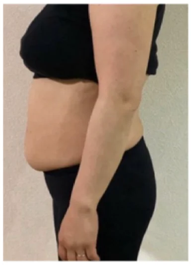 実例②ビフォー