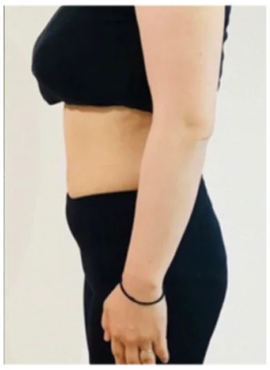 実例②アフター