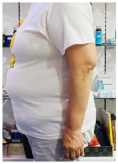 実例③ビフォー