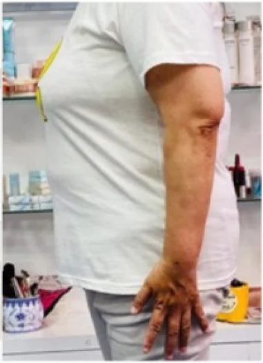 実例③アフター