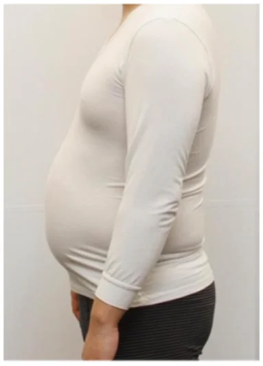 実例④ビフォー