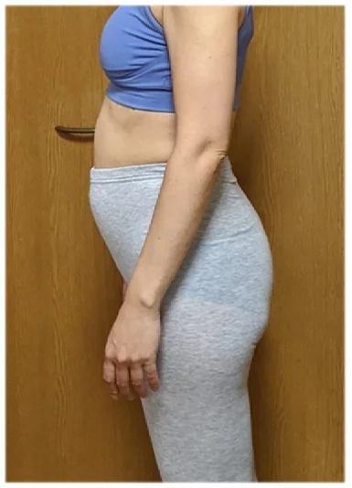 実例⑤ビフォー