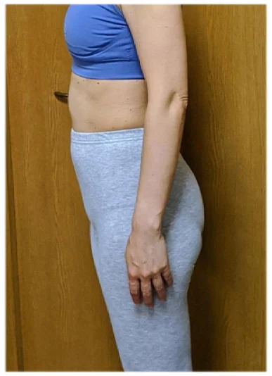 実例⑤アフター